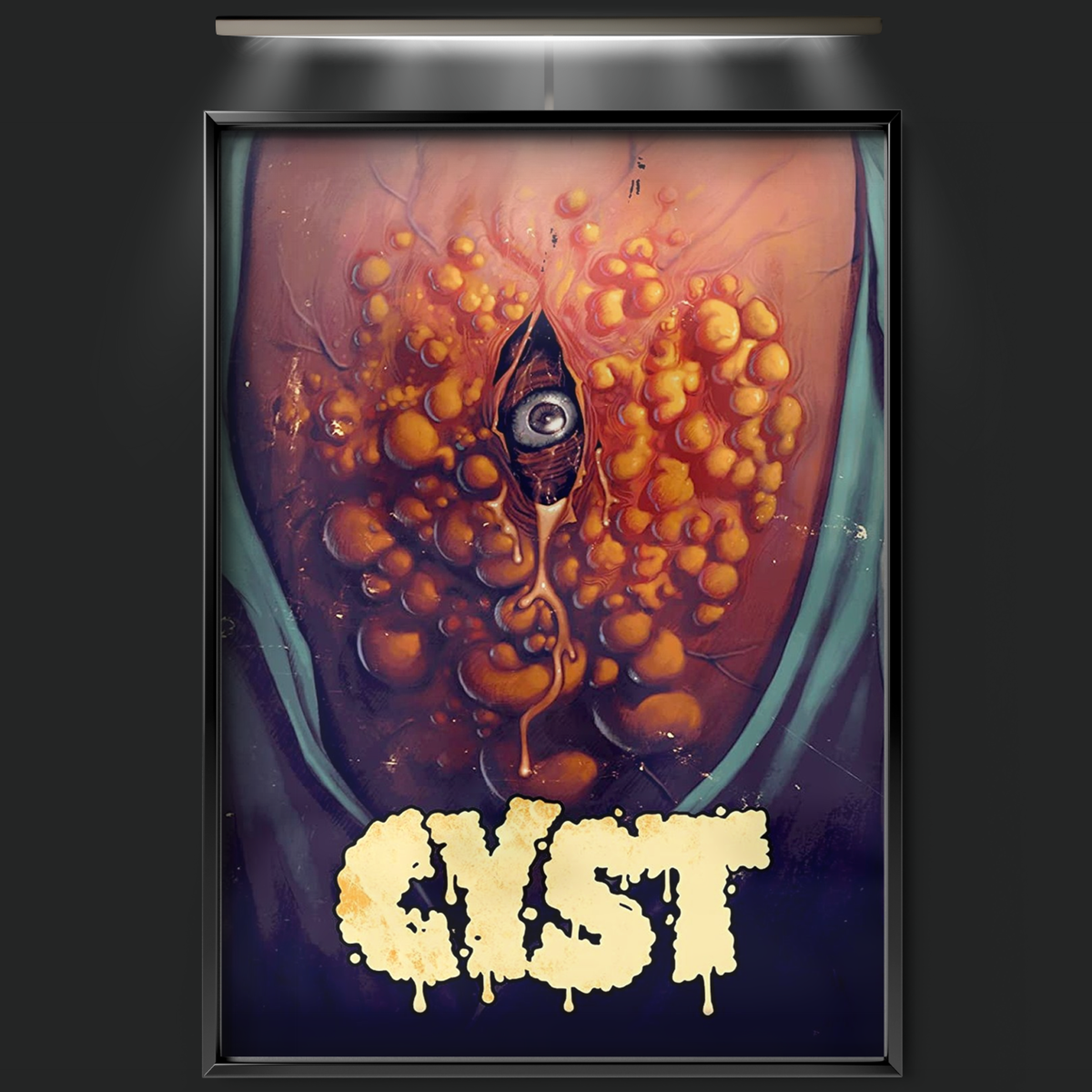 Cyst (2020)